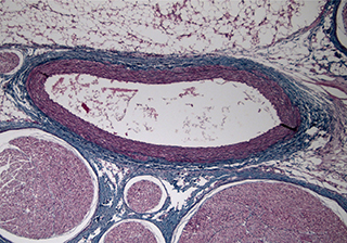 神經(jīng)元細(xì)胞