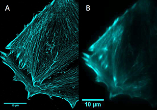 一種光熱療法抑制癌細(xì)胞轉(zhuǎn)移的研究